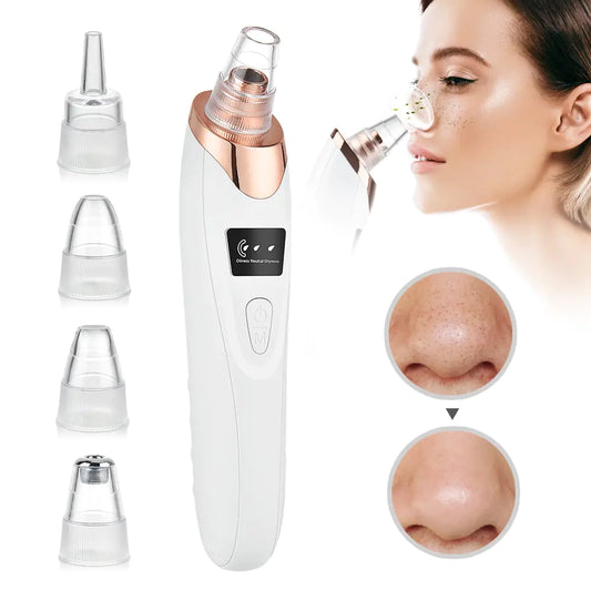 GFL Beauty Electric Blackhead Remover